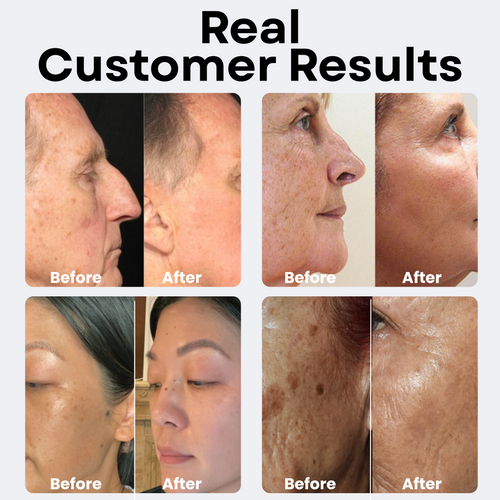 Dark Spot Serum For Older Skin (Buy 1 Get 1 Free)