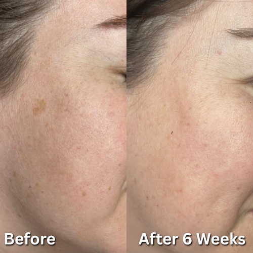 Dark Spot Correcting & Protecting Sunscreen Stick
