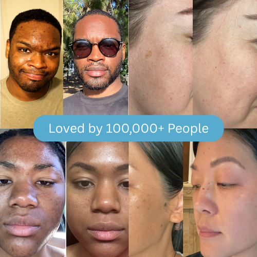 Dark Spot Correcting & Protecting Sunscreen Stick